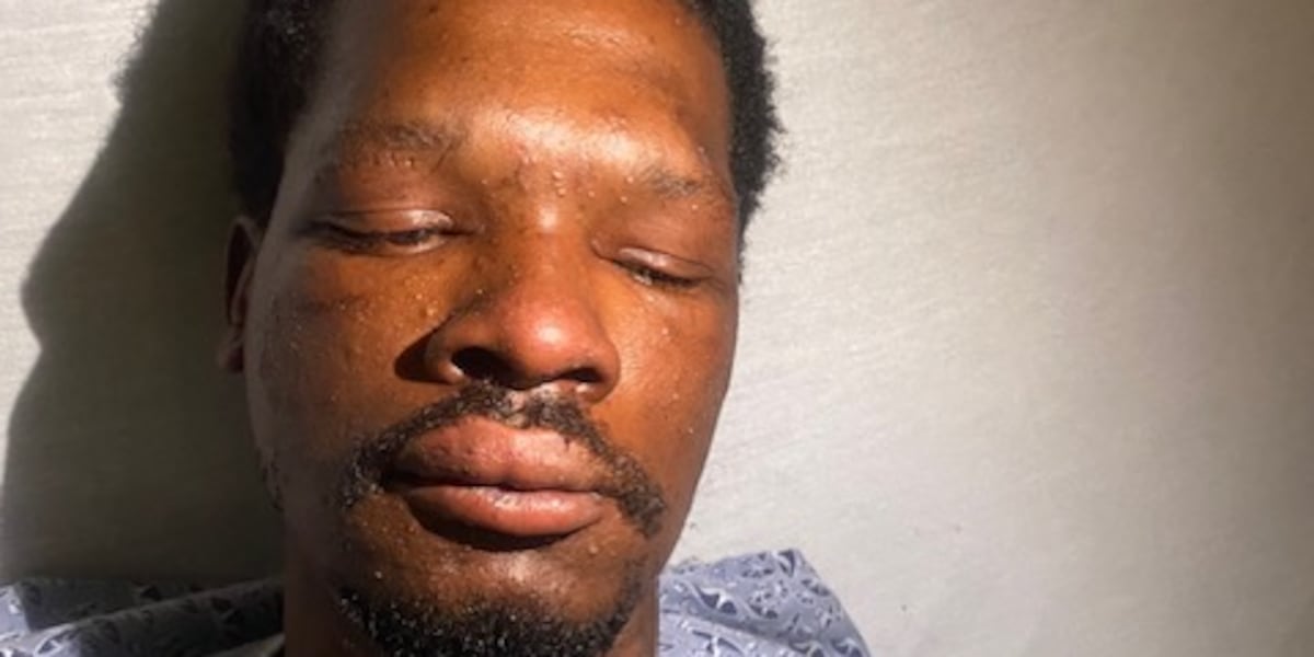 Several people attacked by bee swarm in southwest Las Vegas Several people attacked by bee swarm in southwest Las Vegas