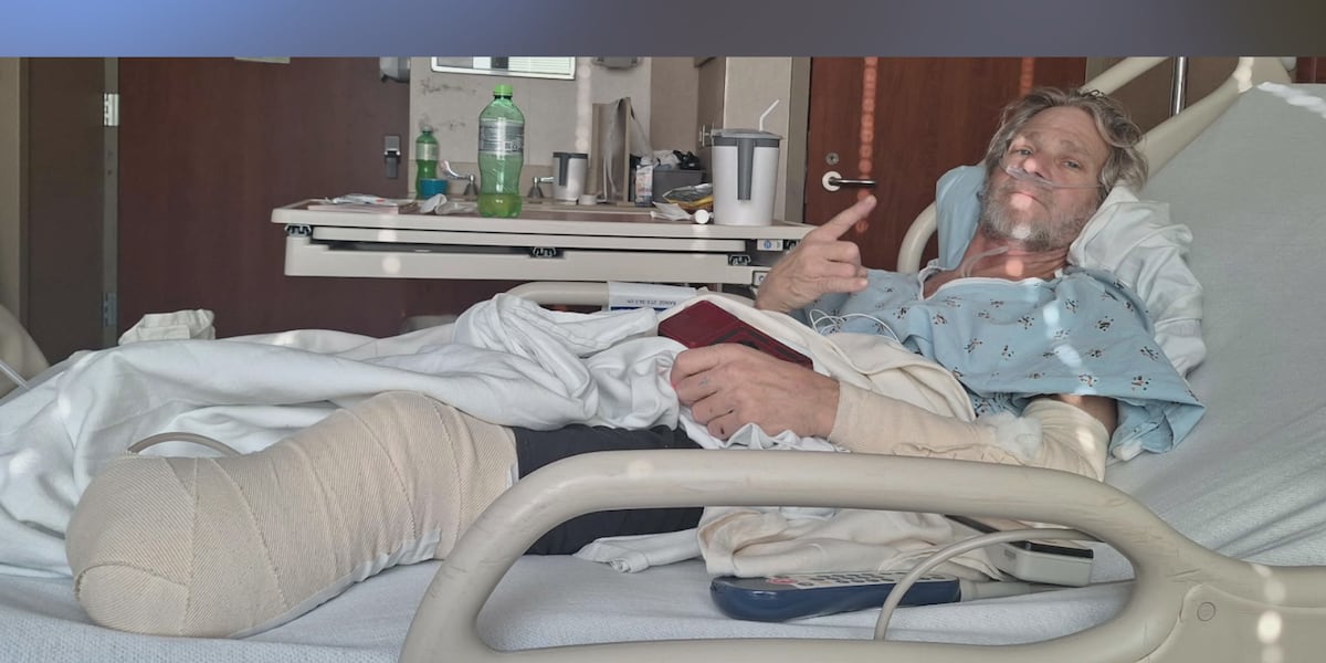 ‘정의를 찾아야 합니다’: 오토바이 운전자, 뺑소니 사고로 다리 일부와 친구 잃어