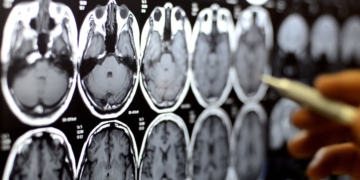 UNLV contributes research to first blood test that helps diagnose Alzheimer’s UNLV contributes research to first blood test that helps diagnose Alzheimer’s