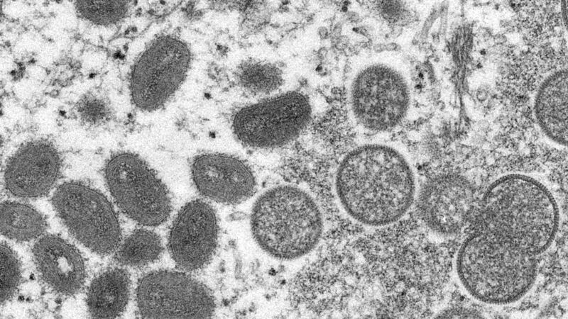 FILE - This 2003 electron microscope image made available by the Centers for Disease Control...