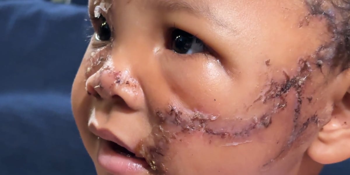 ‘We thought she was dead:’ Las Vegas toddler recovering after dog attack ‘We thought she was dead:’ Las Vegas toddler recovering after dog attack