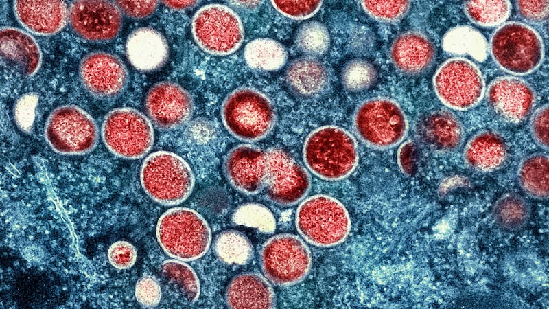 FILE - This undated image provided by the National Institute of Allergy and Infectious...