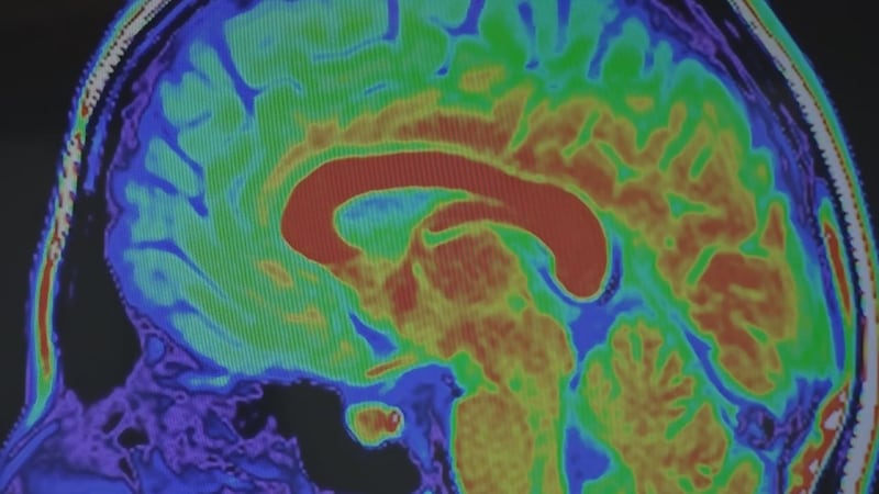 Approximately 41,000 Americans live with a rare, genetic, degenerative disorder that is...