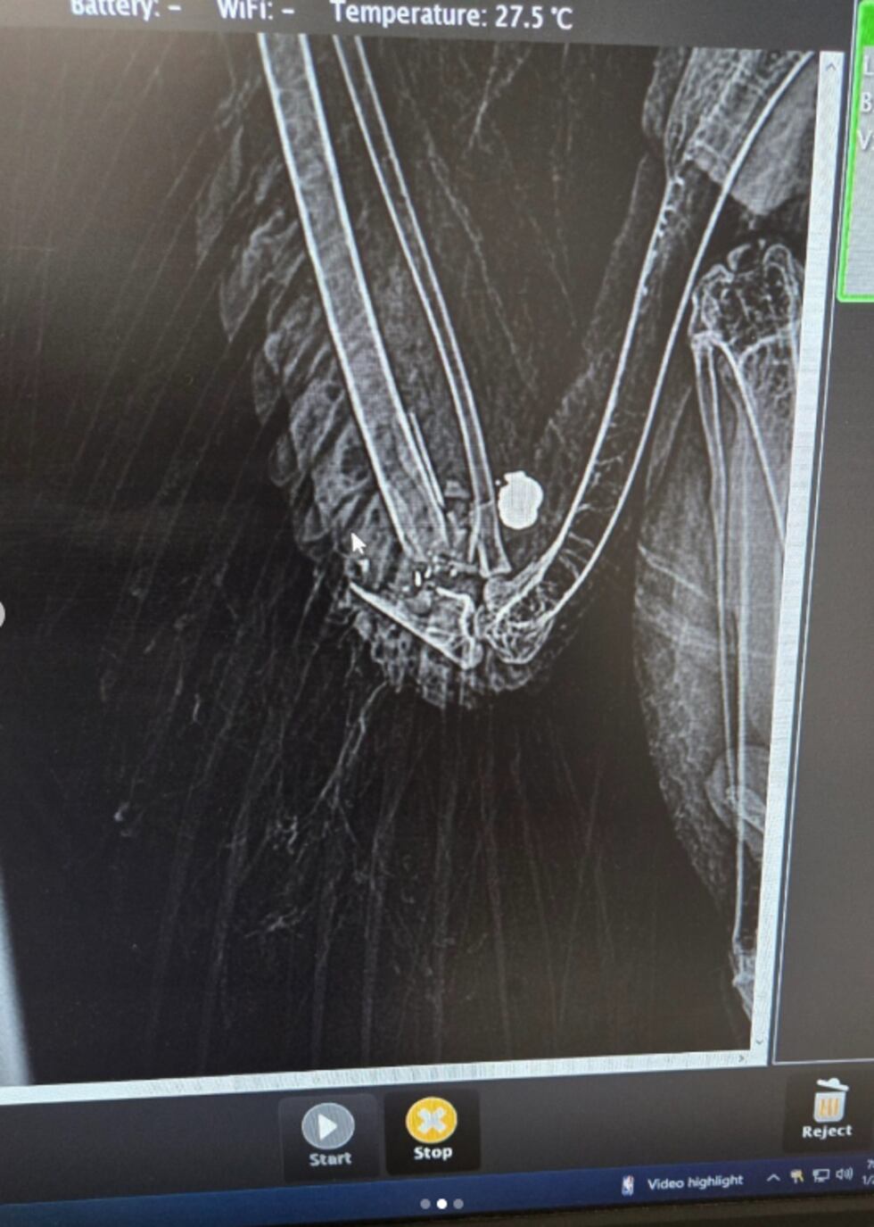 Red-Tailed Hawk shot by pellet gun in Henderson