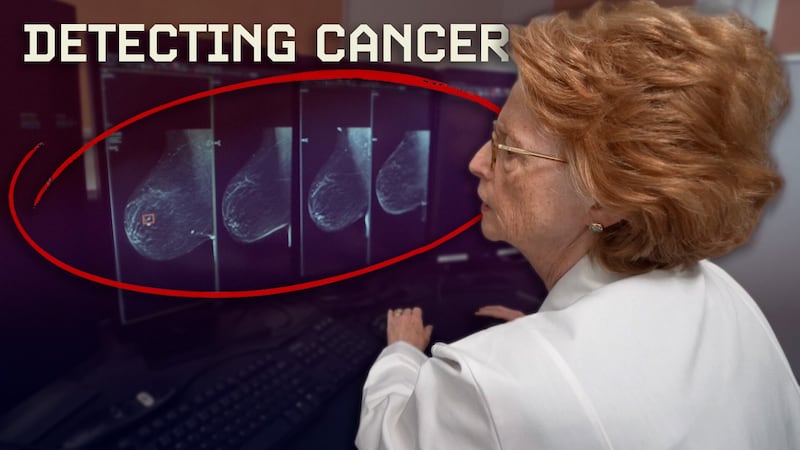 Radiologists say AI is helping detect breast cancer earlier, but with needed guardrails....